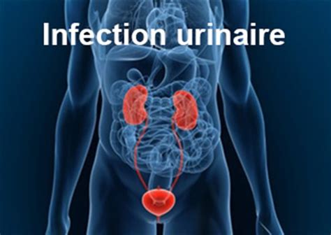 sodomie infection urinaire|Pourquoi peut